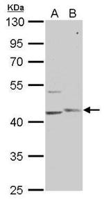 PHKG1 Polyclonal Antibody