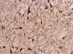 GABRA1 Polyclonal Antibody
