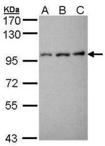 ROR2 Antibody in Western Blot (WB)