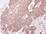 PLK3 Antibody in Immunohistochemistry (Paraffin) (IHC (P))