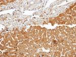 FDFT1 Polyclonal Antibody
