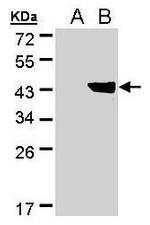 DHDH Polyclonal Antibody