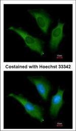 HSP70 Antibody in Immunocytochemistry (ICC/IF)