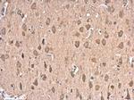 HSP70 Antibody in Immunohistochemistry (Paraffin) (IHC (P))