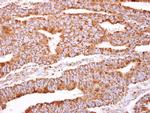 PACSIN2 Polyclonal Antibody