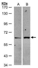 ZSCAN5 Polyclonal Antibody