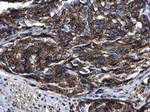 Arfaptin 2 Antibody in Immunohistochemistry (Paraffin) (IHC (P))