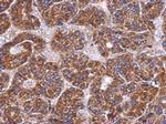 C4BPB Polyclonal Antibody