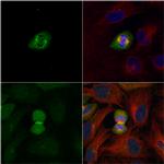 PLK1 Polyclonal Antibody