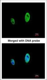 TIMELESS Polyclonal Antibody
