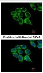 C1r Antibody in Immunocytochemistry (ICC/IF)
