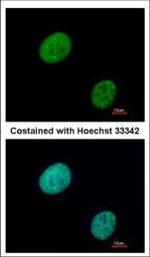 GLI3 Polyclonal Antibody