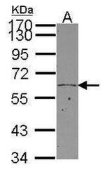 KLF11 Antibody in Western Blot (WB)