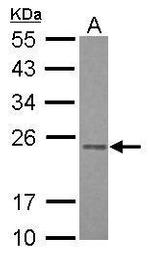 RAB3B Polyclonal Antibody
