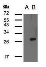 LYPLA1 Polyclonal Antibody