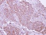 CD27 Antibody in Immunohistochemistry (Paraffin) (IHC (P))