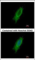 HLA-DPA1 Polyclonal Antibody