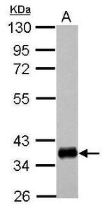 HLA-DPA1 Antibody in Western Blot (WB)