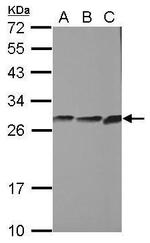 CYB5R2 Antibody in Western Blot (WB)