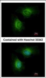 CYP1B1 Polyclonal Antibody
