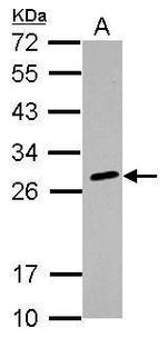 HLA-DQB2 Antibody in Western Blot (WB)