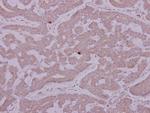 PCYT2 Polyclonal Antibody