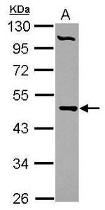 PCYT2 Antibody in Western Blot (WB)
