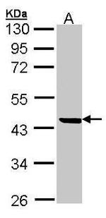SERPINB1 Polyclonal Antibody