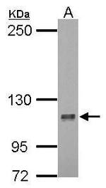 DLG7 Polyclonal Antibody