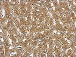 NDST3 Polyclonal Antibody