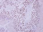 ZNF217 Polyclonal Antibody