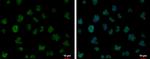 FUBP1 Polyclonal Antibody