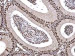 FUBP1 Antibody in Immunohistochemistry (Paraffin) (IHC (P))