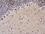 FUBP1 Antibody in Immunohistochemistry (Paraffin) (IHC (P))