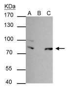FUBP1 Antibody in Immunoprecipitation (IP)
