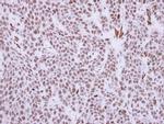RCC1 Antibody in Immunohistochemistry (Paraffin) (IHC (P))