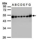 RCC1 Antibody in Western Blot (WB)