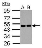 RCC1 Antibody in Western Blot (WB)