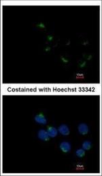 GALNT6 Polyclonal Antibody