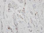 GALNT6 Antibody in Immunohistochemistry (Paraffin) (IHC (P))