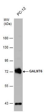 GALNT6 Antibody in Western Blot (WB)