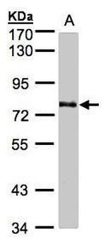 GALNT6 Antibody in Western Blot (WB)