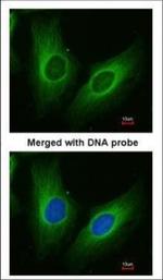 AKR1C3 Polyclonal Antibody