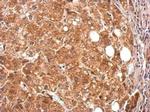 PIK3C2A Antibody in Immunohistochemistry (Paraffin) (IHC (P))