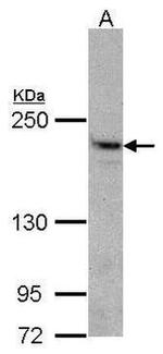 PIK3C2A Antibody in Western Blot (WB)