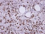 EPM2A Antibody in Immunohistochemistry (Paraffin) (IHC (P))