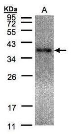 EPM2A Antibody in Western Blot (WB)