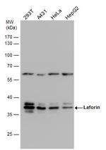 EPM2A Antibody in Western Blot (WB)