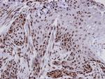 FCP1 Polyclonal Antibody