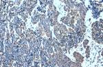 MMP7 Polyclonal Antibody